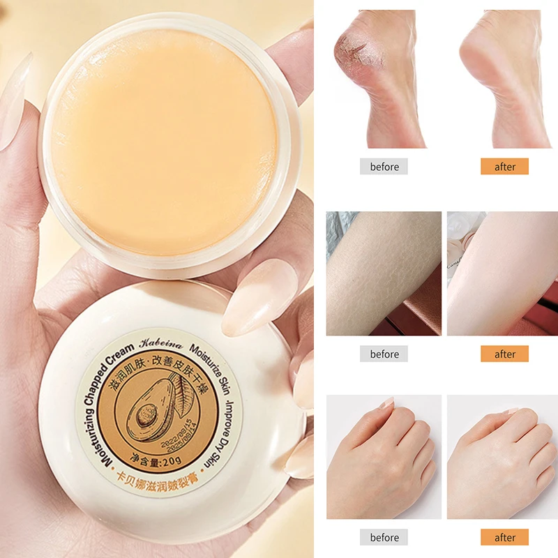 

Herbal Anti Cracked Heel Treatment Cream Anti-Drying Removal Callus Dead Skin Balm Hand Foot Moisturizing Repair Skin Care Mask