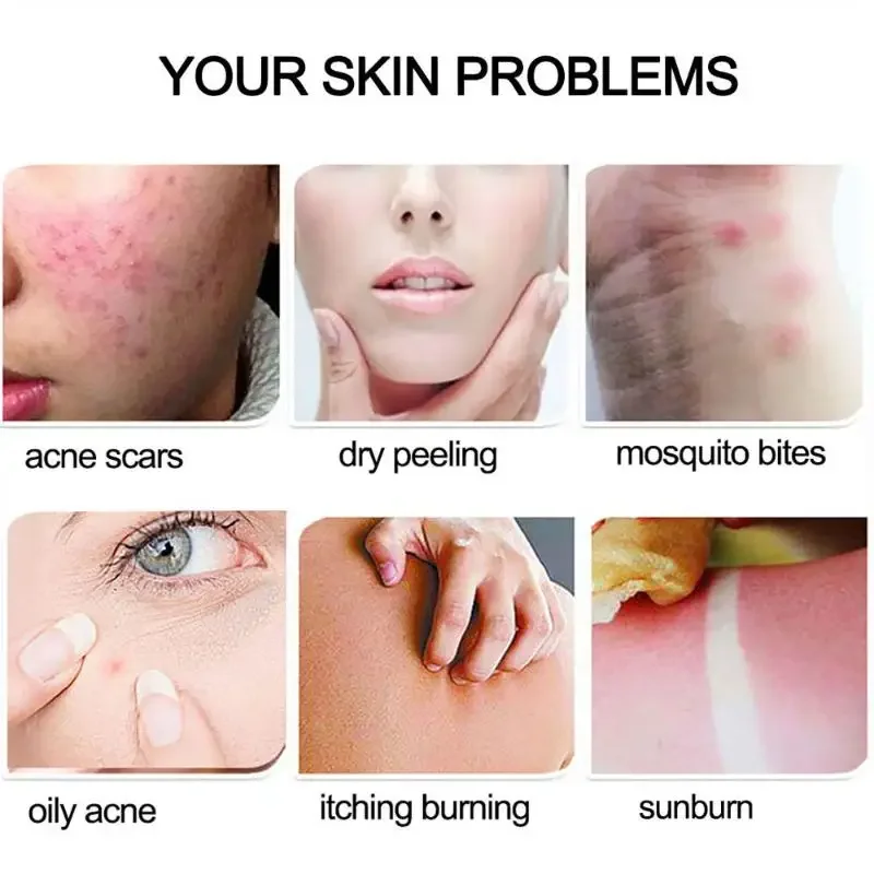 Skin Care Products 99% Aloe Vera Gel Moisturing Skin Face Cream Shrink Pores Day Cream Skincare Sleeping Mask Korean