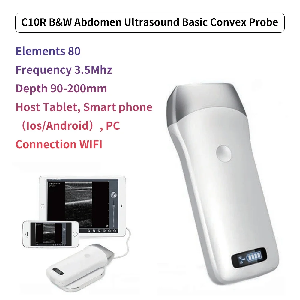 Portable Wireless Ultrasound Convex Probe Scanner Machine Aluminium Box Support IOS Android Windows
