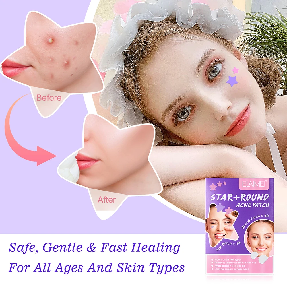 

New Colorful Heart Acne Removal Pimple Patch Invisible Acne Tools Pimple Acne Concealer Face Spot Scar Stickers 126/132Pcs