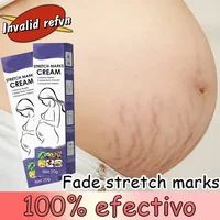 Gentle Skin Care Improves Elasticity Effective After Pregnancy Stretch Marks Removal Powerful Maternity Cream Nourishes Skin 1