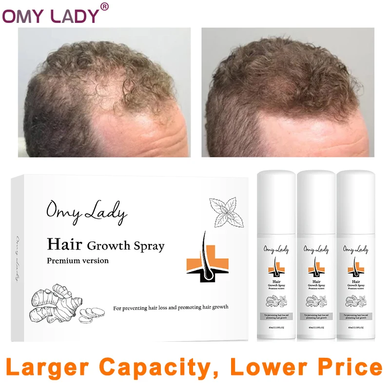 OMY LADY Hair Growth Spray Anti Hair Loss Products Natural With No Side