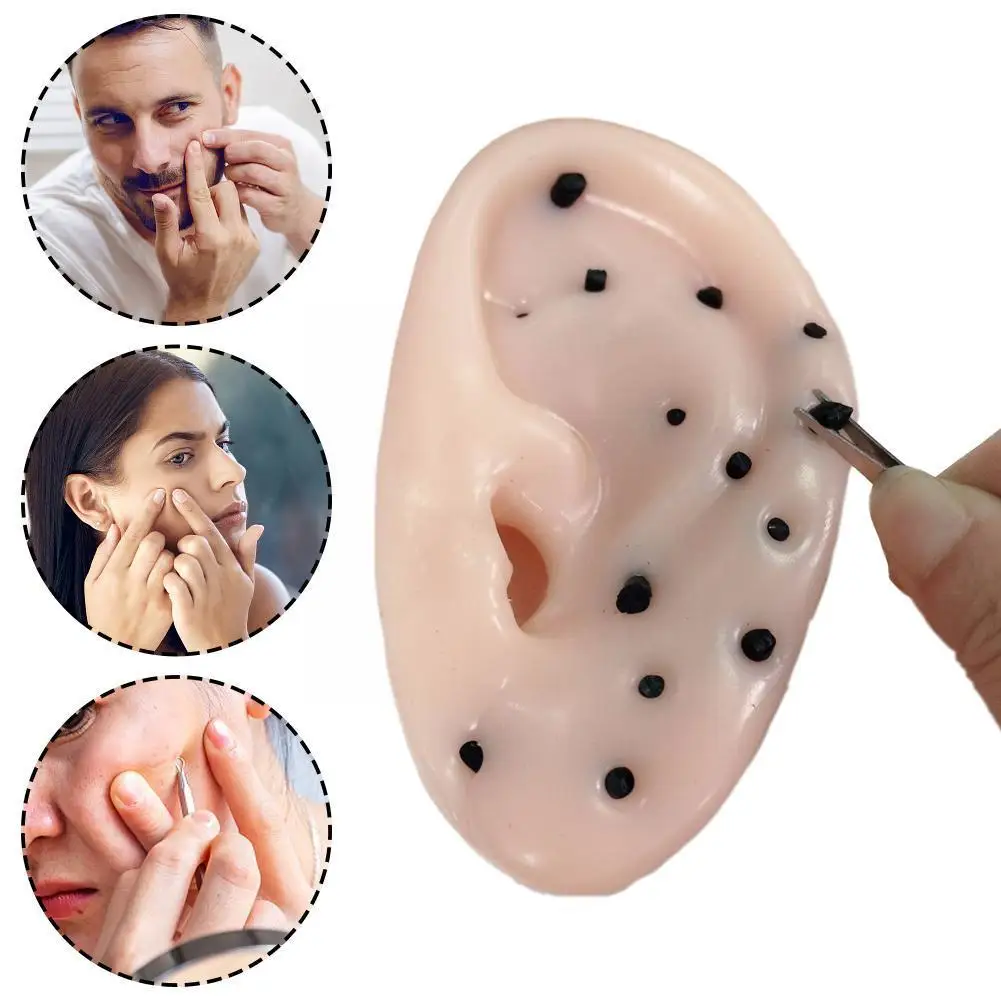 Pimple Popper Toys Ears Shaped Pimple Popping Remover