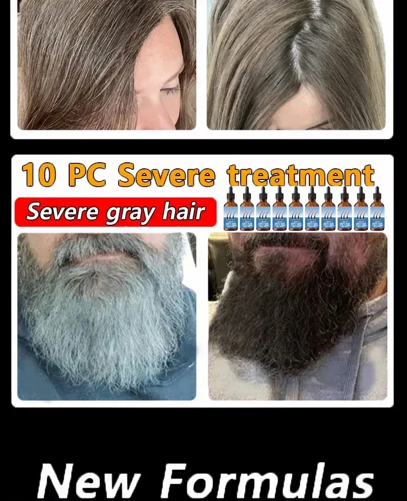 restauration de la couleur naturelle des cheveux et restauration de la sant&eacute; des cheveux blancs au noir