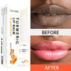 Turmeric Remove Dark Lip Balm Lighten Melanin Exfoliating Lip Oil Fade Lip Line Dead Skin Moisturizing Brighten Repair Lip Care 1