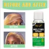 GOIPLE Wig Installation Kit Melting Spray Glueless Adhesive Extra Hold Waterproof Lace Front Wig Glue Remover Styling Wax Stick 5