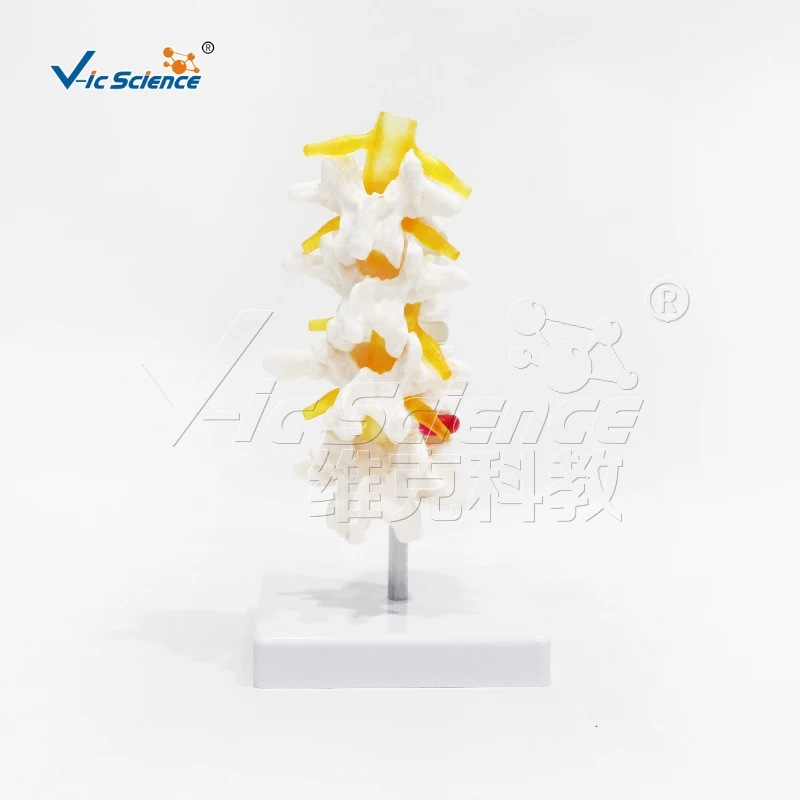 Medical science Four-segment lumbar model