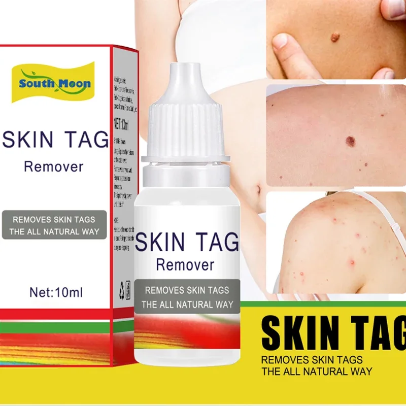 

Skin Tag Remover Serum flat gram Wart Treatment Painless corn Mole warts Removal liquid Skin Freckle Face Tags Essential Oil