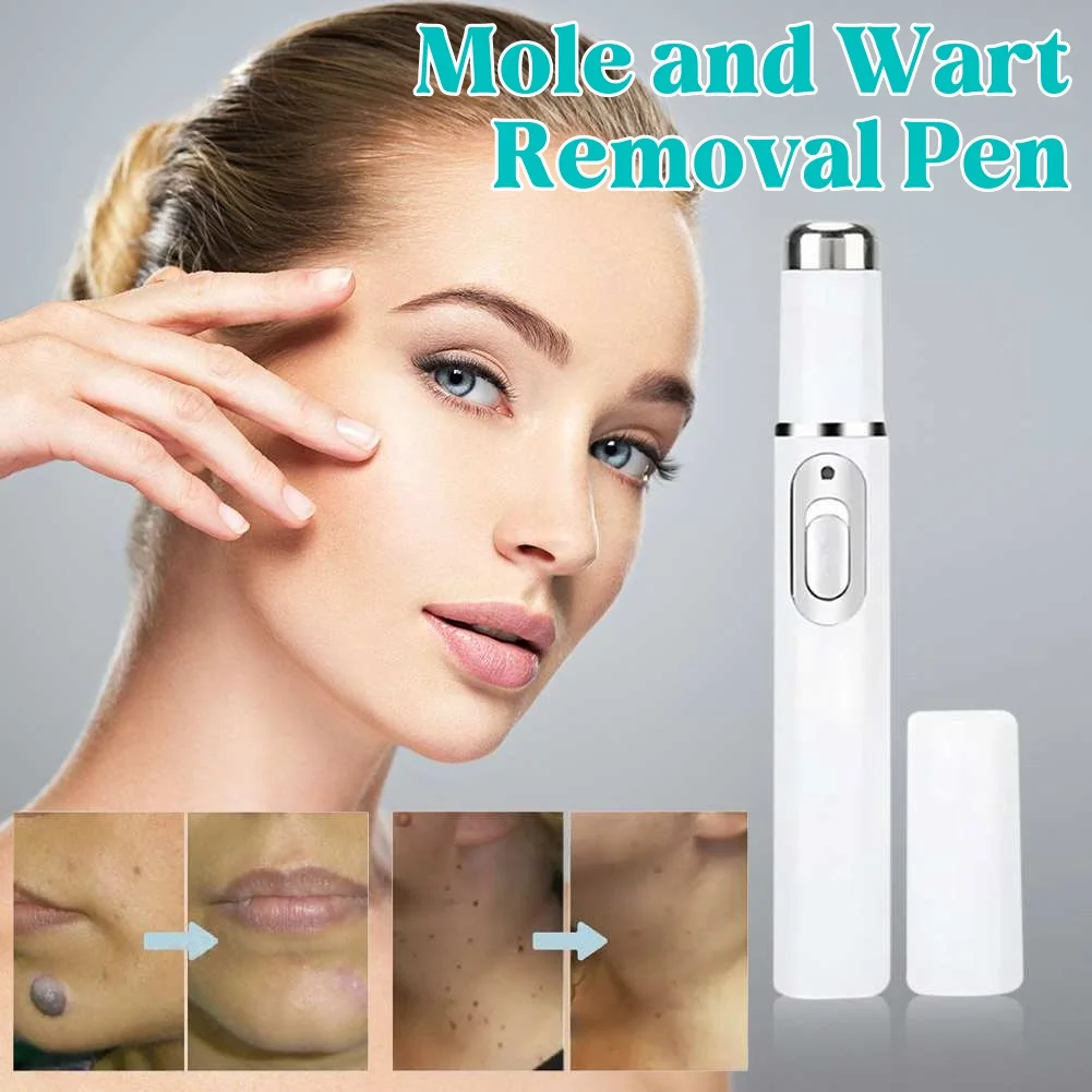 Advanced Skin Blemish and Spot Removal Pen with Blue Light Therapy