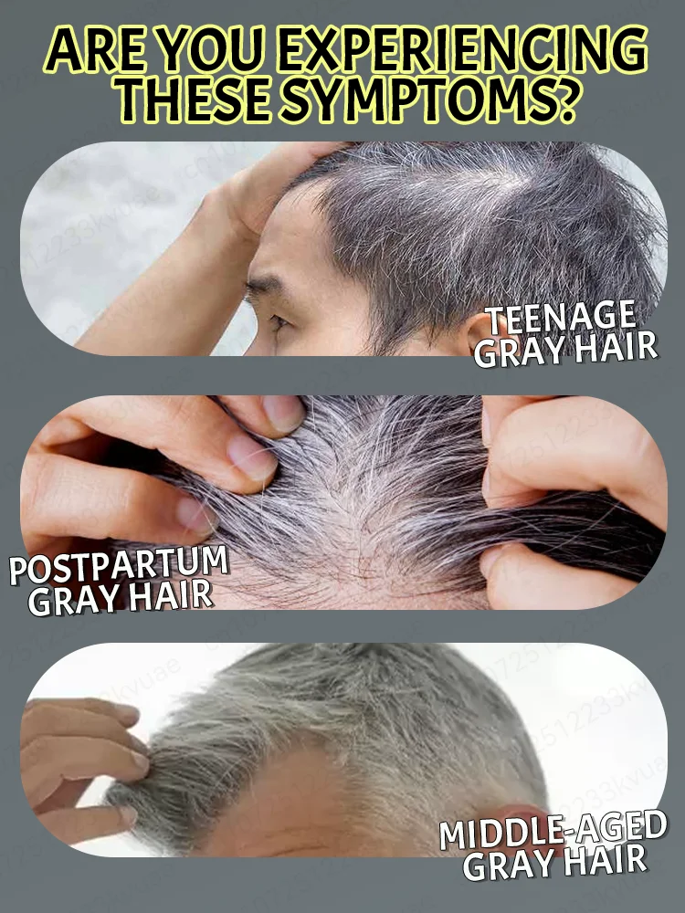 Hair Oil Hair Essence Oil Natural Anti-Gray Hair Serum 7-Day Dark Hair Restoration & 98% Gray Prevention-Root Repair with Botanical Extract