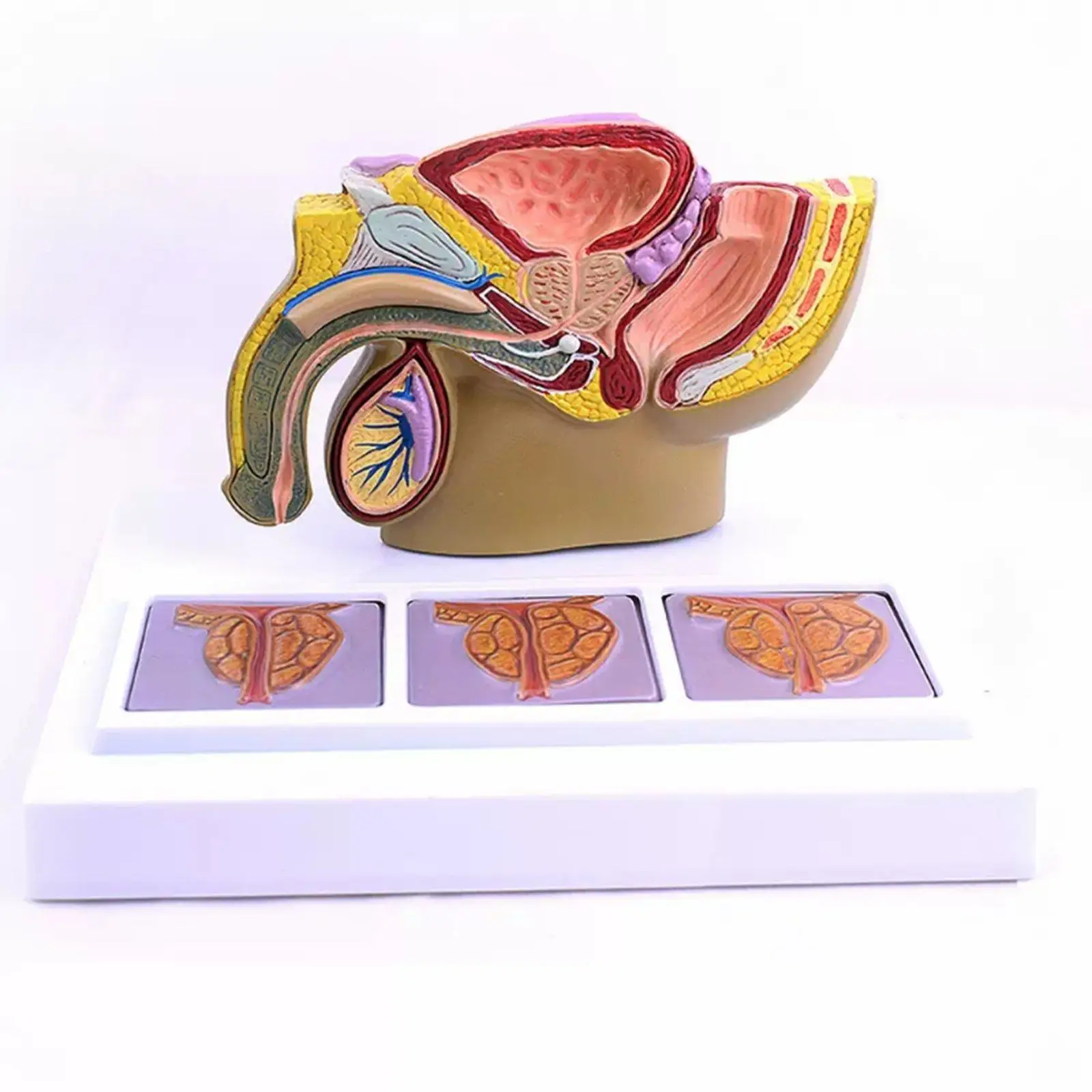 

Human Male Pelvis Prostate Pathology Sagittal Section Model Medical School