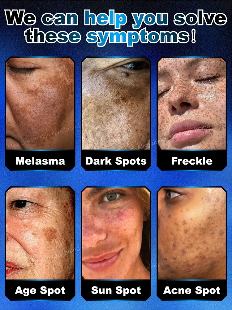Effectively solves all pigmentation symptoms 3