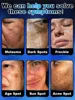 Effectively solves all pigmentation symptoms 3