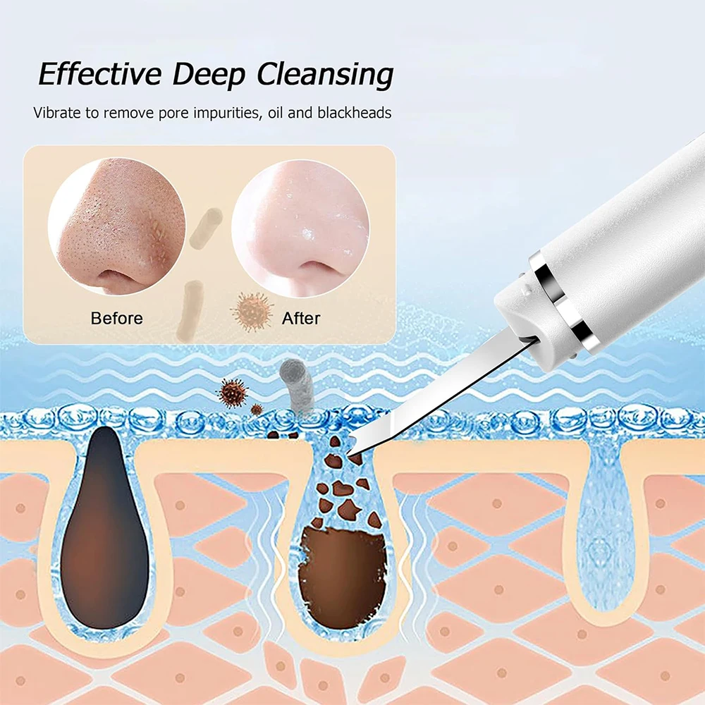 Ultrasonic Skin Scrubber Peeling Blackhead Remover Deep Face Cleaning Vibration Ion Acne Pore Cleaner Facial Shovel Scrubber