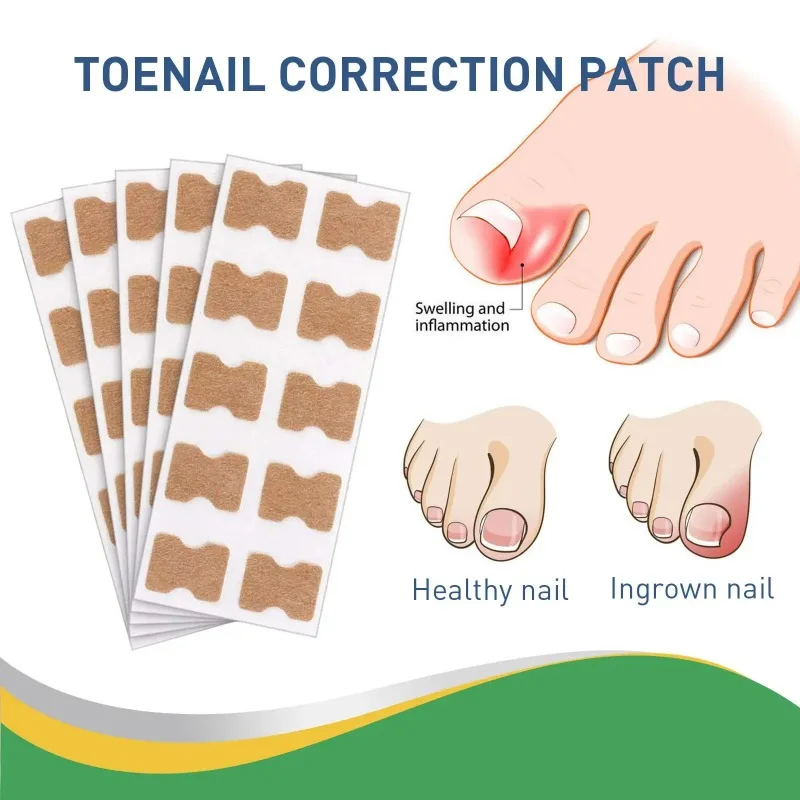 Painless Nail Fungus Therapeutic Instrument Laser Foot Care Whitening Nail Removing Fungus Therapeutic Device u&ntilde;as 발톱무좀 nail fungus remover