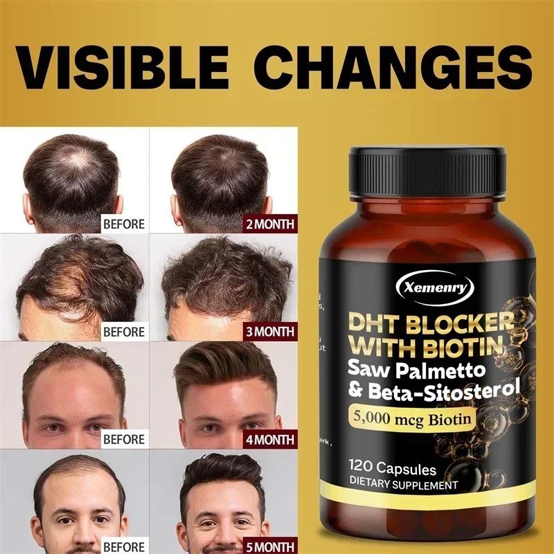 DHT Blocker - Promotes Hair Growth Helps with Healthy Urination Natural DHT Blocker for Men & Women 6