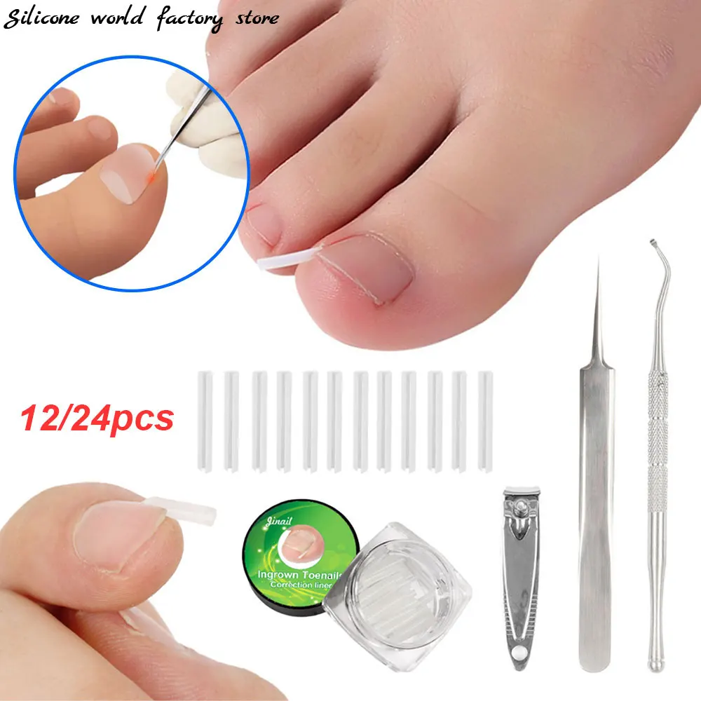 Ingrown Nail Corrector 12/24pcs C-shaped Filling Pad For Nail Inlay Pedicure Correction Tool