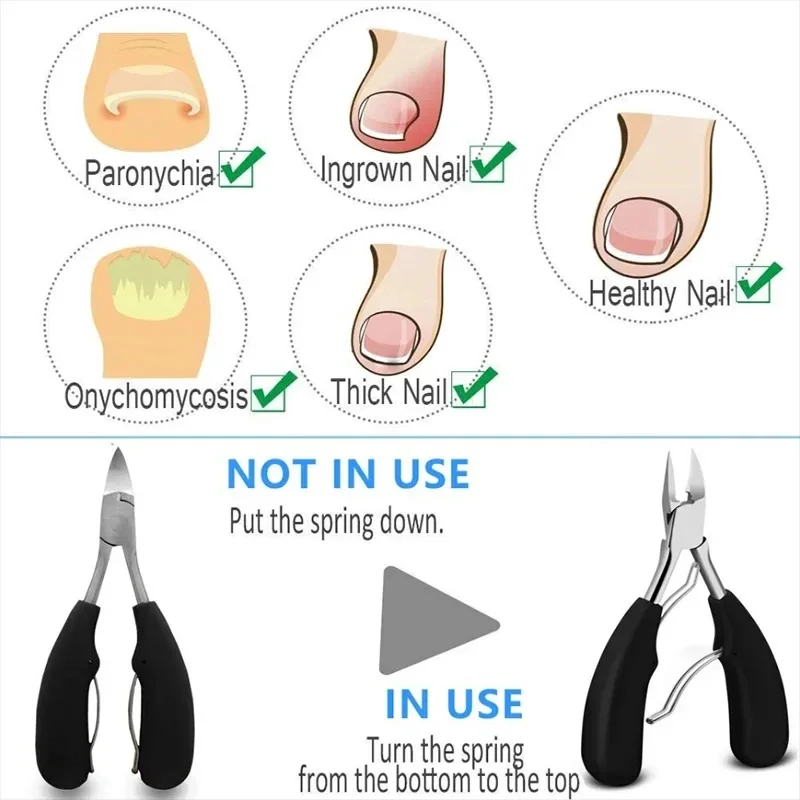 Tronchesino per Unghie Professionale, Strumenti per Pedicure e Paronichia, Set Manicure, Acciaio Inossidabile, Lama Curva Affilata, Pinze Grandi - immagine 2