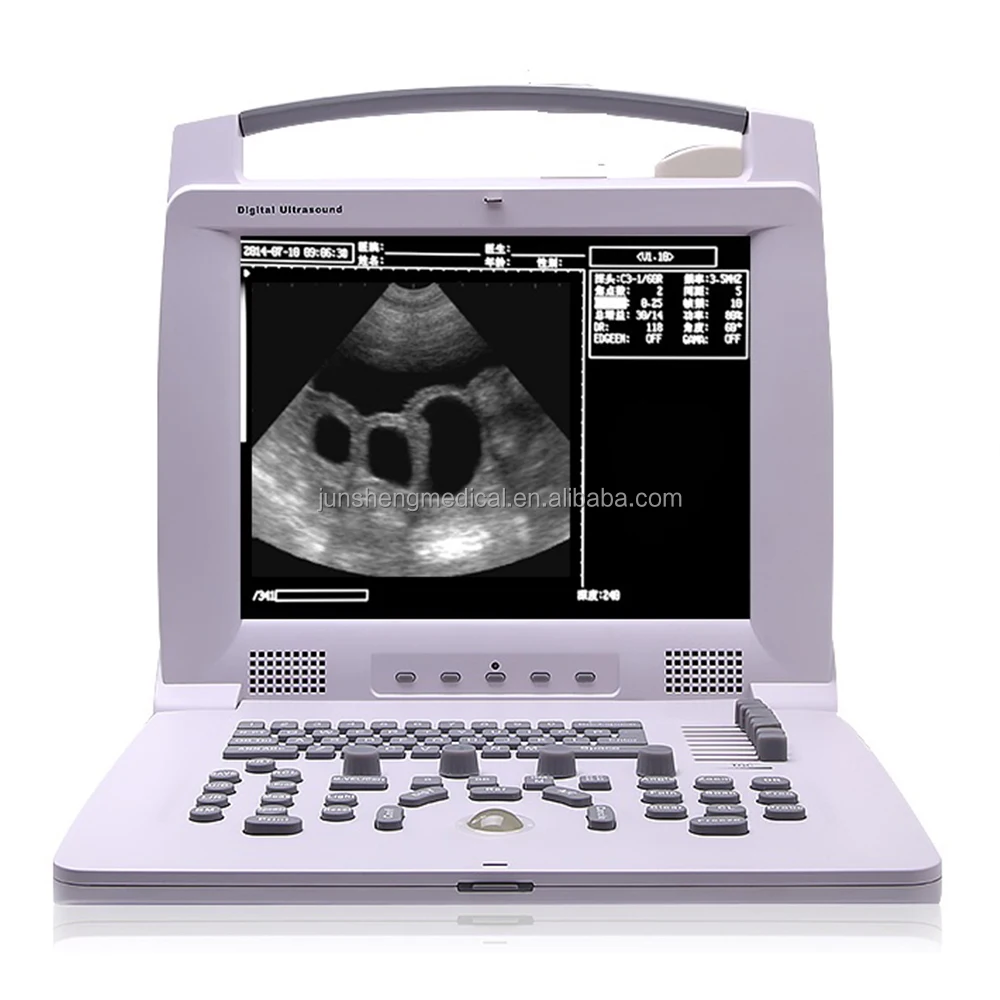 

JSPL318VP Professional Veterinary B /W Portable Handheld Portable Veterinary Ultrasound Scanner Dog Vet Ultrasound