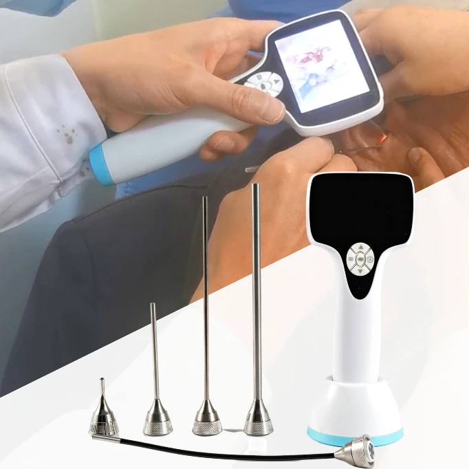 

Цифровой Медицинский отоскоп BESDATA по заводской цене, беспроводной Эндоскоп С ЛОР, видео отоскоп для ушей, носа, горла, осмотр ветеринарный