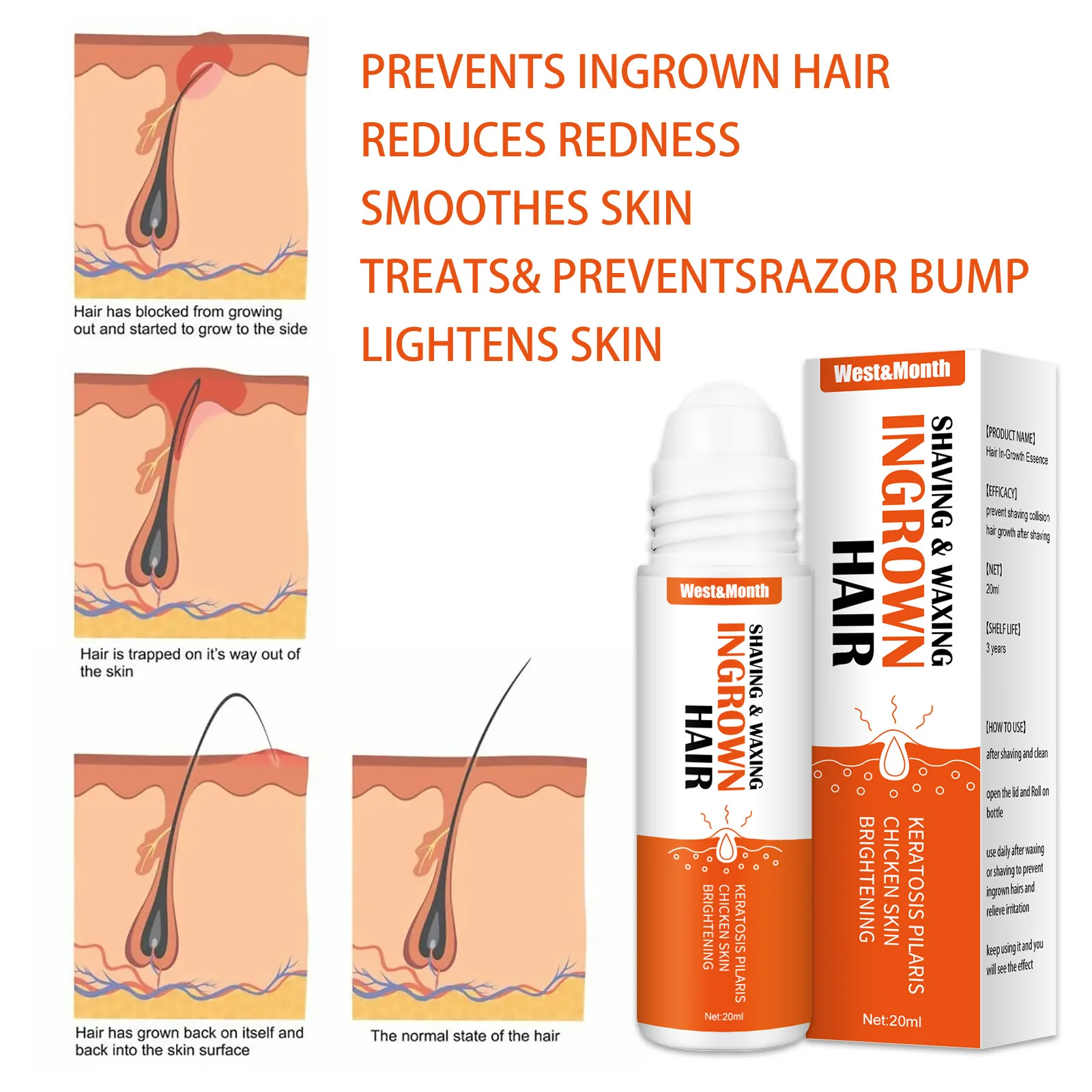 Ingrown Hairs Treatment After Shave Repair Serum Solution Dark Spot Reduce Redness for Vanish Pfb Skin Care Prevent Razor Bumps hair removal skin care