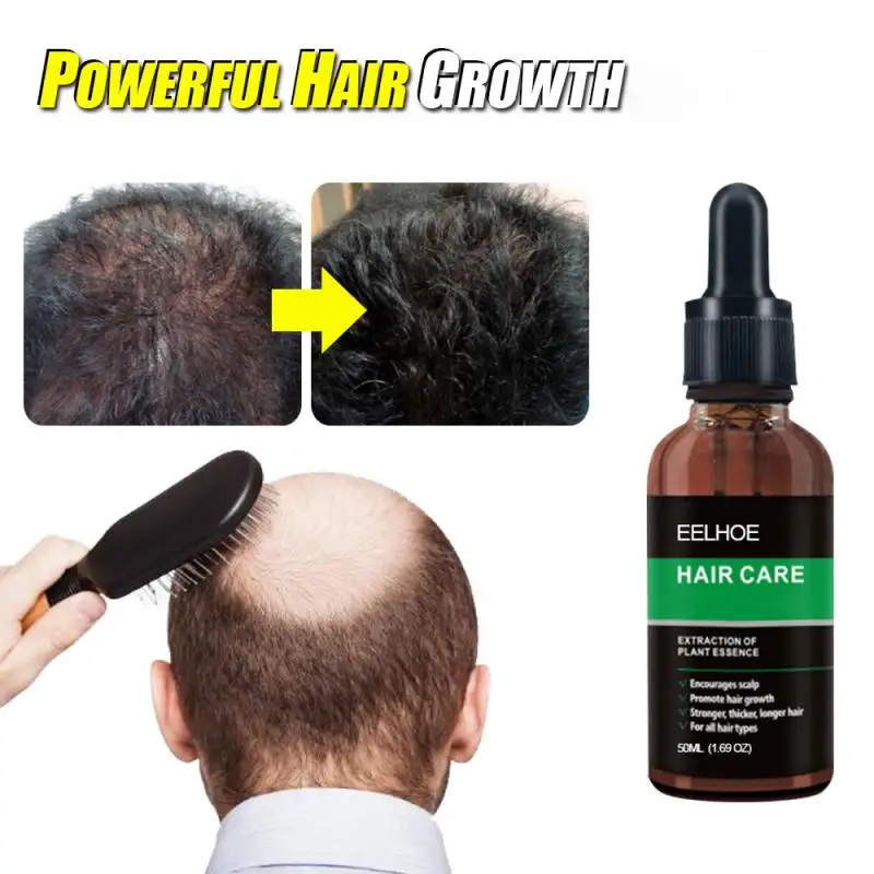 

New Powerful Hair Loss Treatment Ginger Hair Care Growth Hair Oil Anti Hair Loss Dry Damaged Repair Hair Care