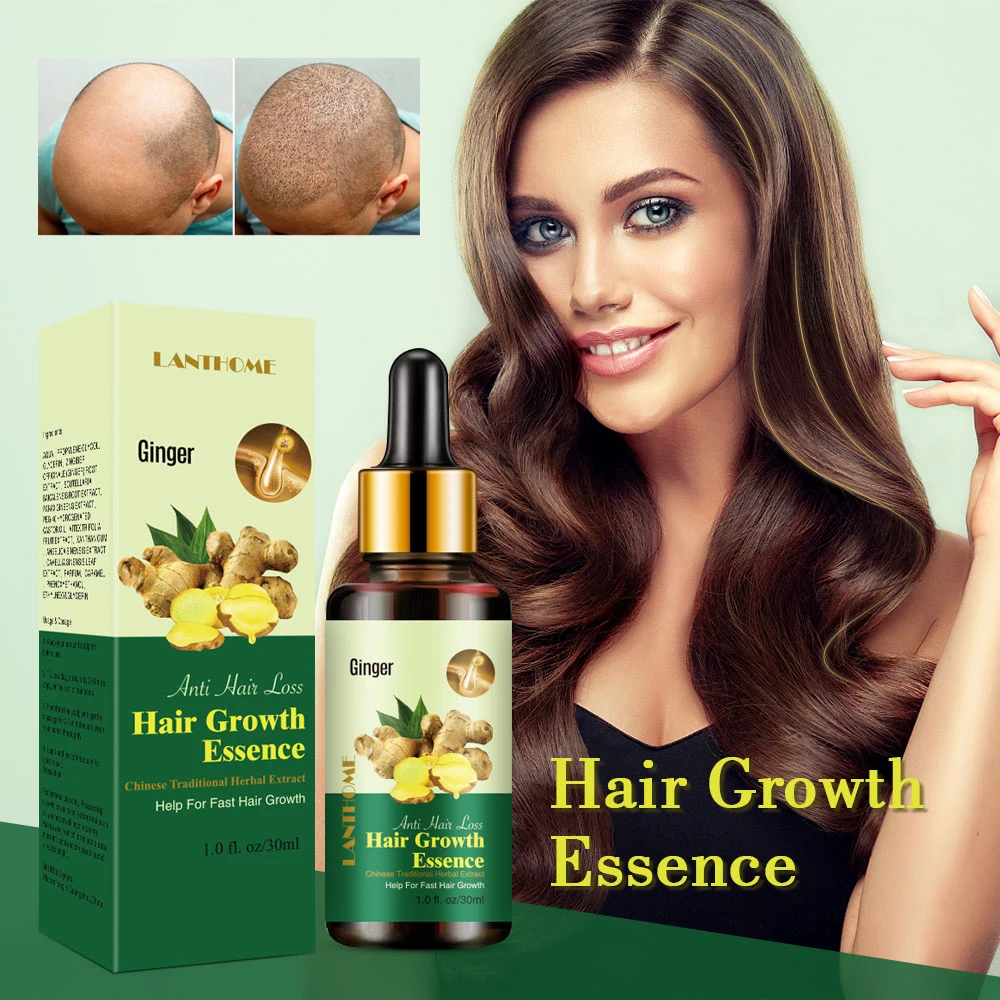 Castor Oil Ginger Extract Hair Growth Product Gentle Hair Loss Treatment Natural Method Help Grow Quickly Hair Care For Unisex