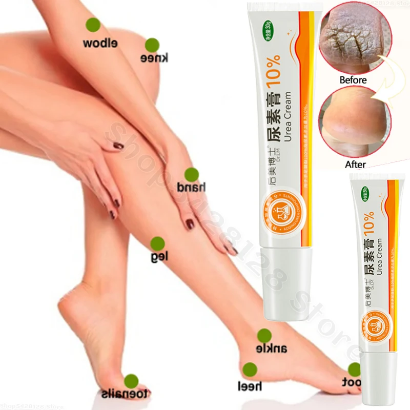

Urea Cream 10% Improves Dry Cracked Hands and Feet Repairs Moisturizes Mildly Improves Dry Cream Softens Cutin