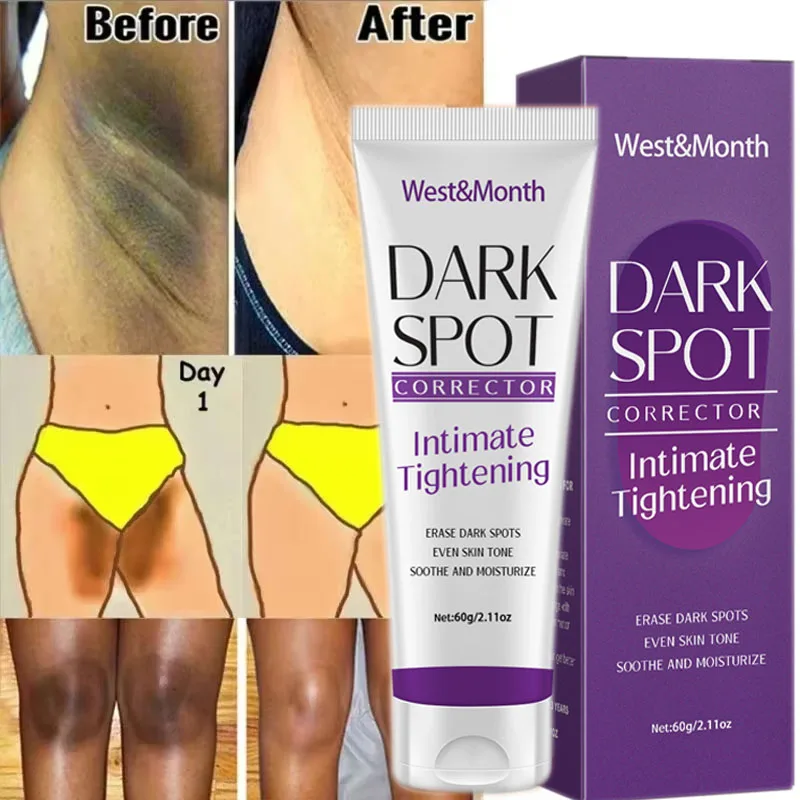 Whitening Body Cream Body Whitening Cream whitening body cream whitening cream brightening cream brightening body cream body skin care cream underarm knee buttocks private parts bleach inner thighs intimate area remove melanin brighten skin care