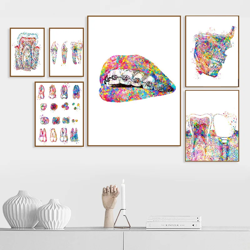 Tooth Implant Dentist Anatomy Medical Canvas Painting Dental Art Poster