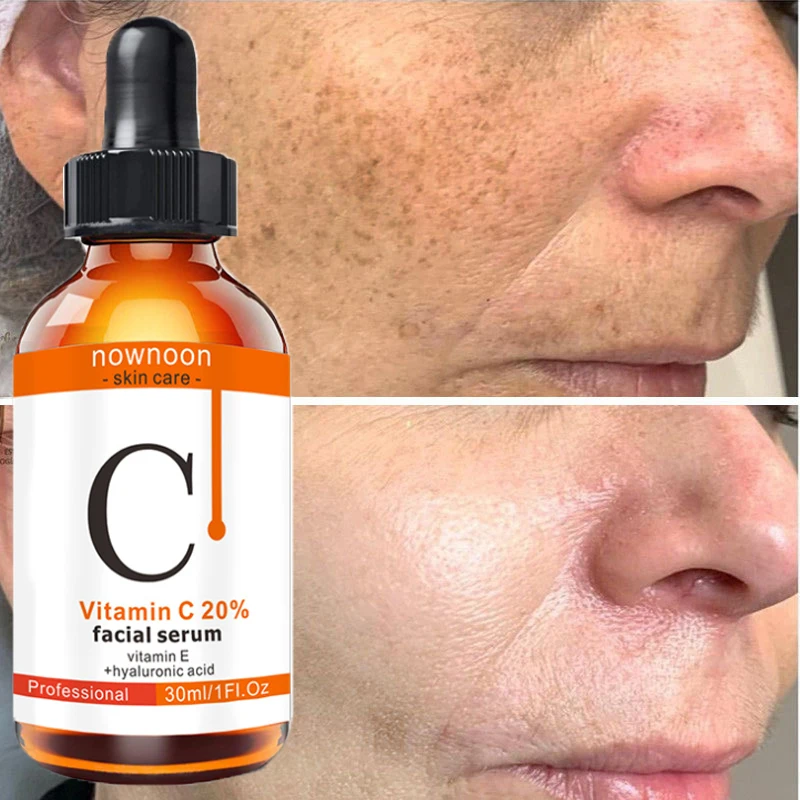 

Vitamin C Whitening Face Serum Brighten Removal Melanin Moisturizing Smooth Anti-Wrinkles Improve Sagging Dull Skin Care Essence