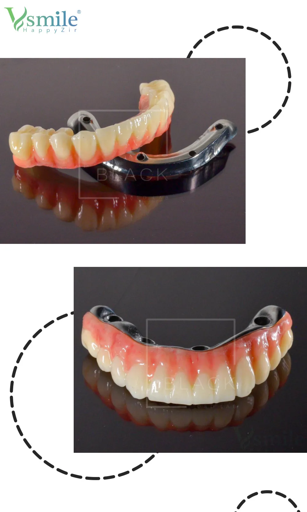 Vsmile Dental Multilayer PMMA 98x14mm offenes System für Cad/Cam Dental labor Harz Zahnarzt Prothesen materialien – Detail 5