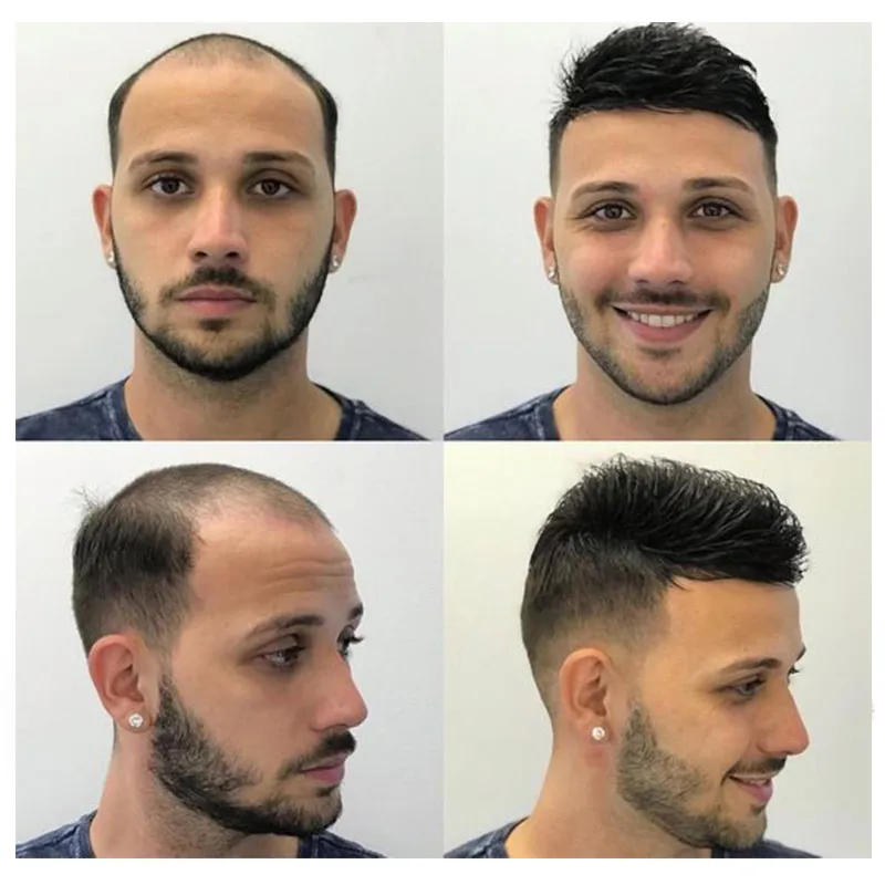 Mono & Skin Capillary Male Hair Prosthesis Toupee Mens Wig Hair Replacement System Unit Human Wig For Men Realistic Man human hair toupee