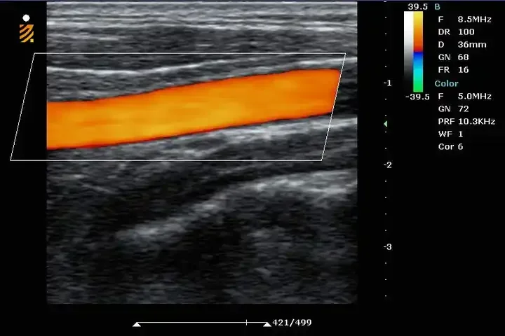 Рисунок 5 - 2022 горячая Распродажа BPU90