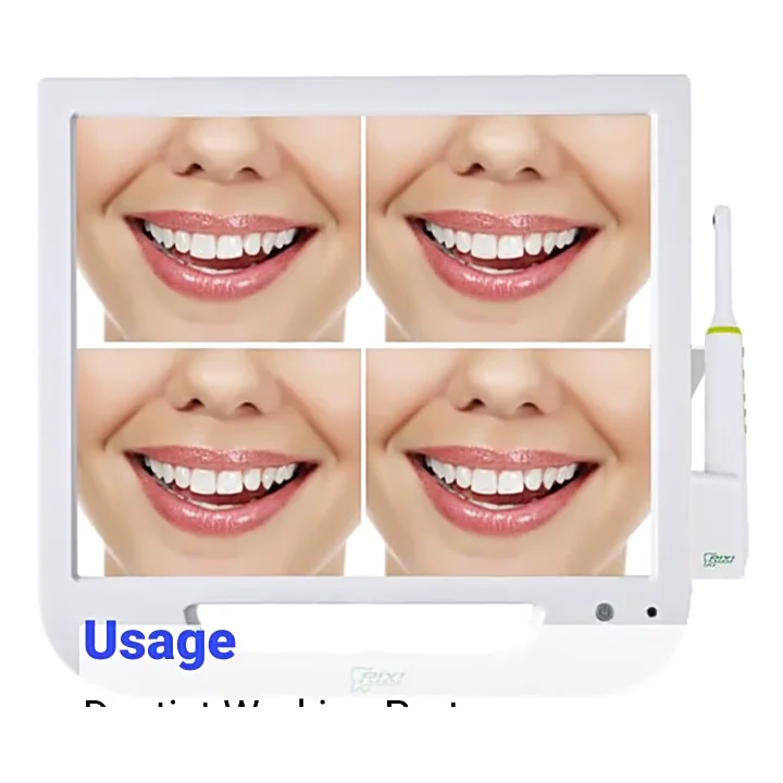 

New product in China endoscope camera computer system intraoral camera scanner 6 white led lights