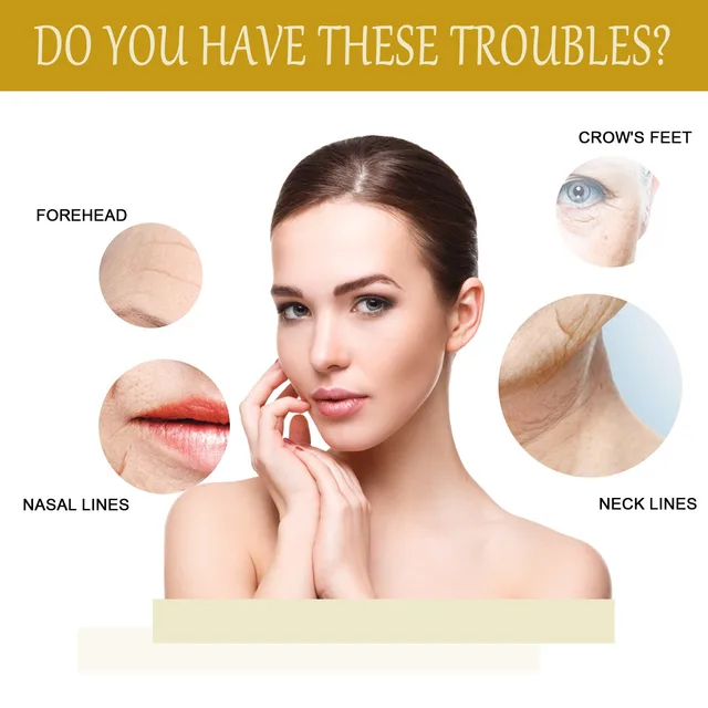 Bee Venom Anti Wrinkle, Anti-aging, Polypeptide, Hyaluronic Acid 5