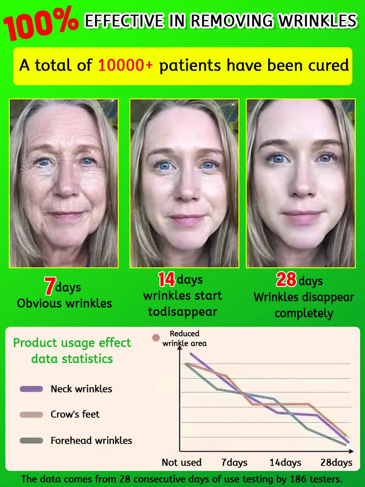 Wrinkles disappear, the first choice for women who love beauty 6