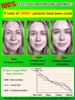 wrinkles disappear become beautiful now 6