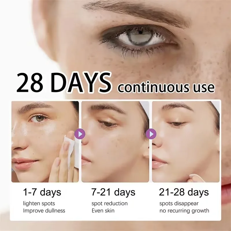 Powerful Dark Spots Remover Freckle Whitening Serum Melanin Correcting Anti Pigmentation Brighten Korean Day Night Facial Care 3
