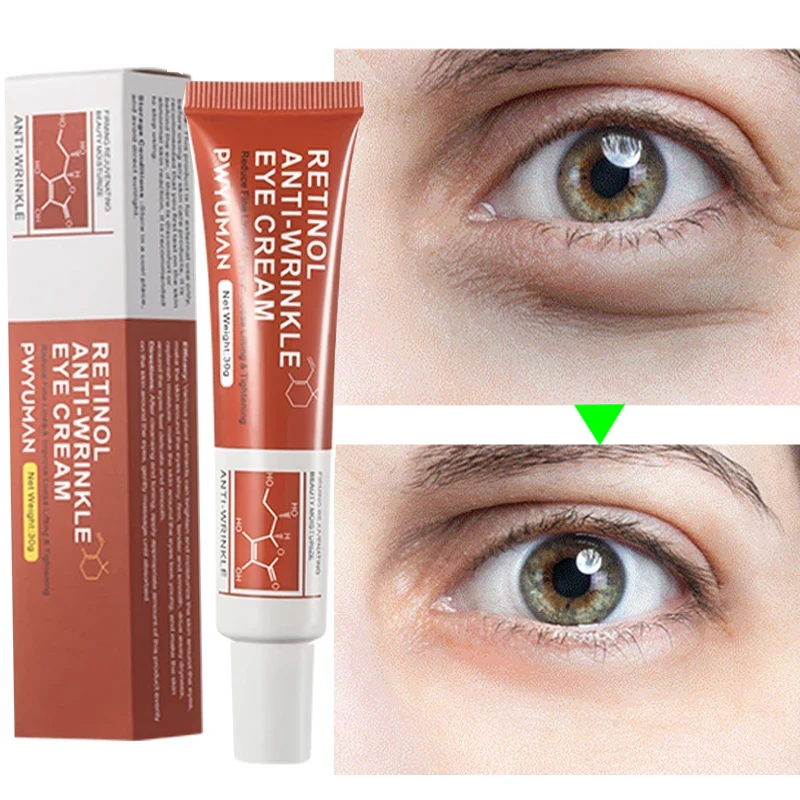 

Retinol Anti-wrinkle Eye Cream Remove Eye Bags Dark Circles Fade Fine Lines Anti-Aging Puffiness Lift Firming Brighten Eye Care