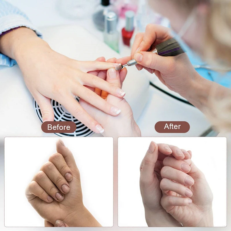 Рисунок 6 - набор шлифовальных насадок для