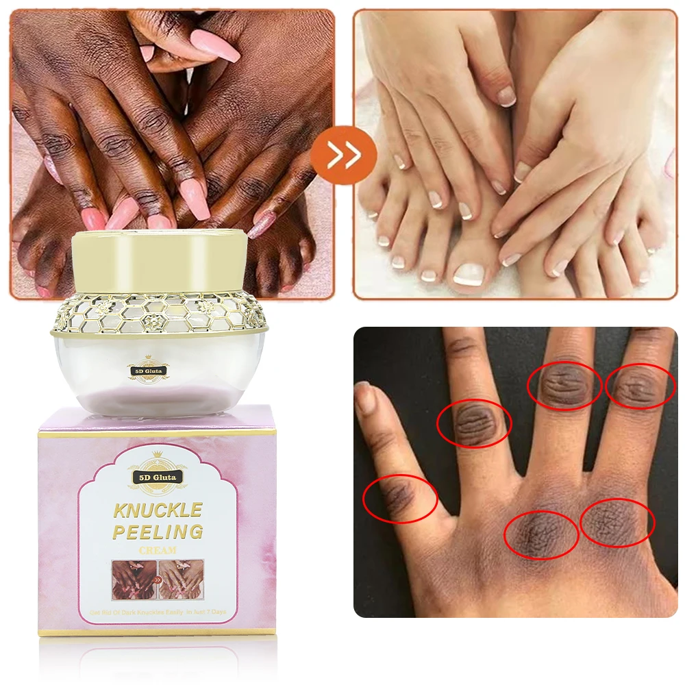 Knuckle Exfoliating Cream Brightens Reduces Dark Spots For Clearing Black Finger Joints Knees Elbows Body Beauty Care Cream