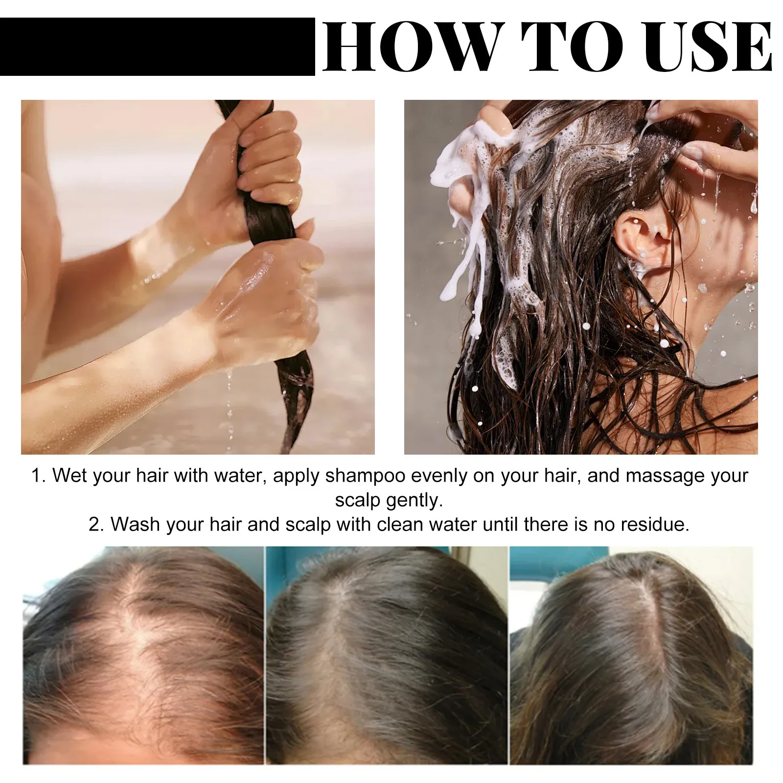 Anti Hair Loss Shampoo Repair Baldness Reduce Dandruff Itching Scalp Treatment Strengthen Thicken Nourishing Hair Growth Shampoo 6