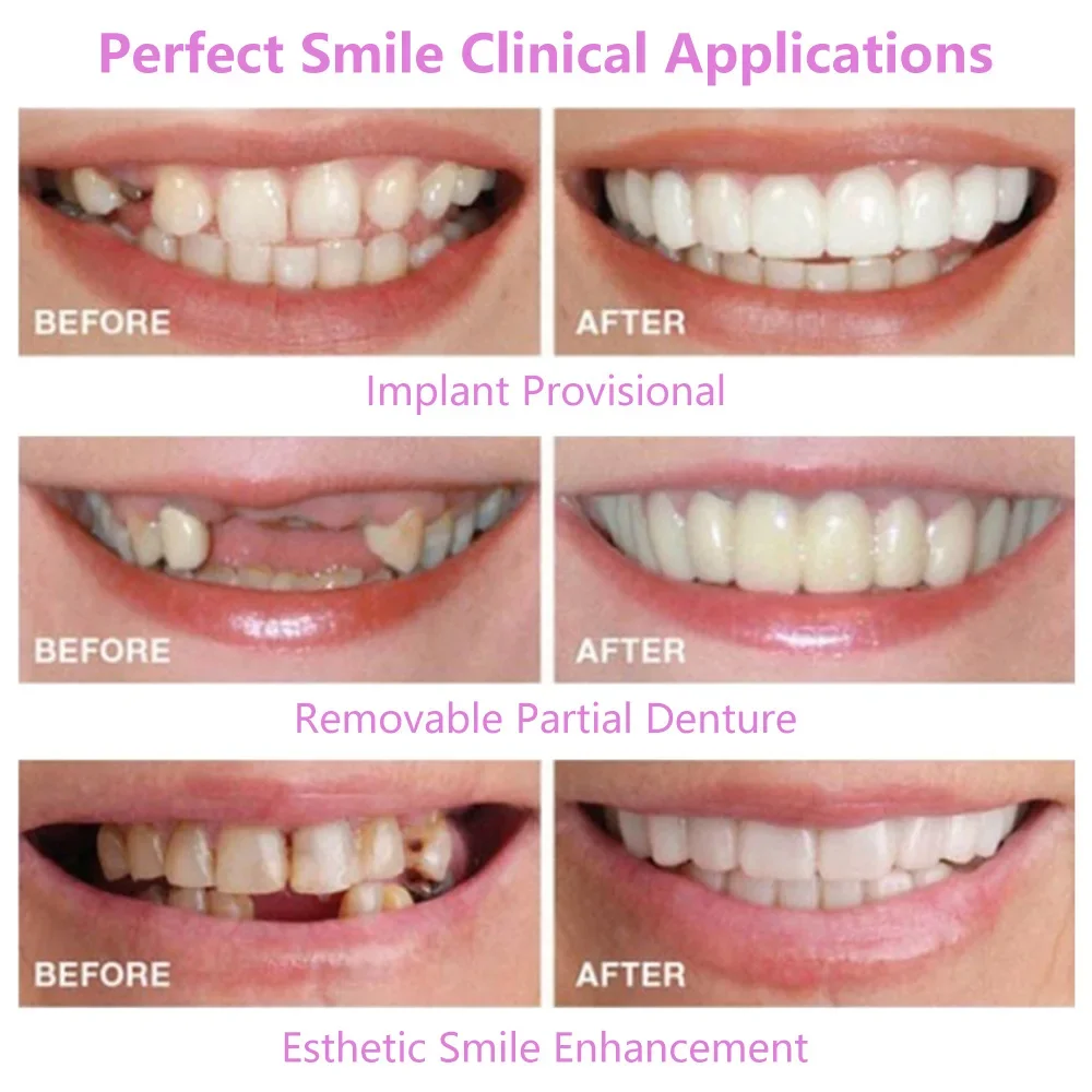 Upper Lower Fake Teeth Cover Perfect Bright Veneers Comfort Fit Flex Dentures Braces Whitening Toy makeup toy,princess pretend toys