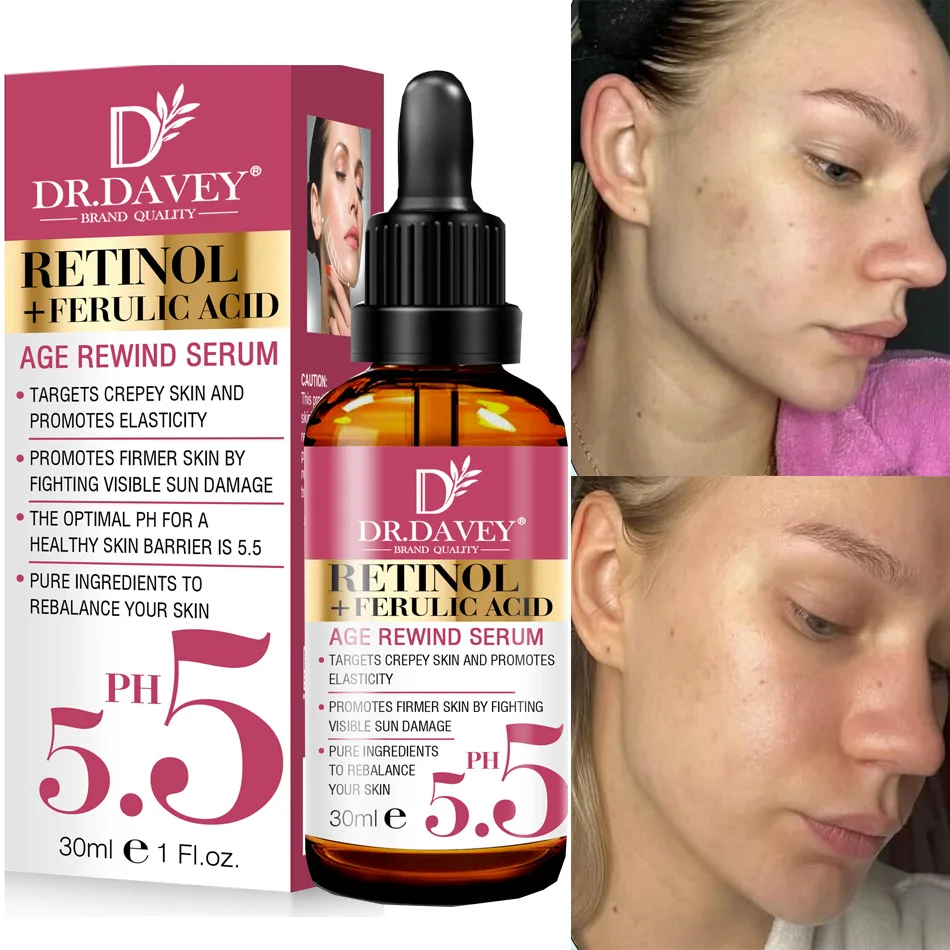 Body Lotion Cream Retinol Body Lotion Firming for Face Body Dry Skin Improves Elasticity Age Rewind Serum for Face Serum Brightening