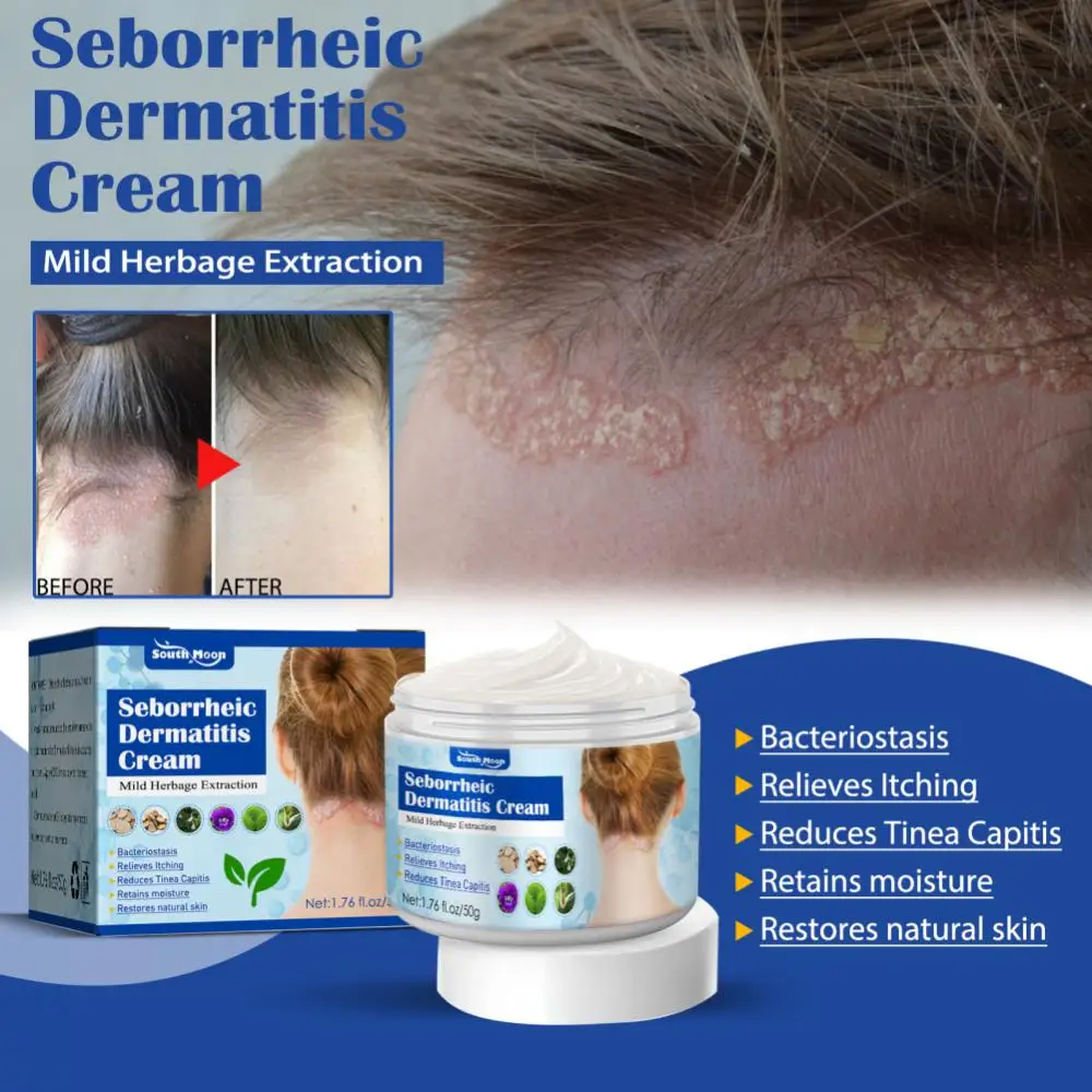 Scalp Treatment Hair Psoriasis Seborrheic Dermatitis Eczema Head Acne Pruritus Shampoo Repair Remove Dandruff