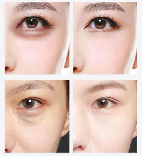 골드 캐비어 모이스처라이징 크리스탈 콜라겐 아이 마스크, 주름 방지, 안티 에이징, 아이 스킨 케어 패치, 미세 라인, 60 개 4