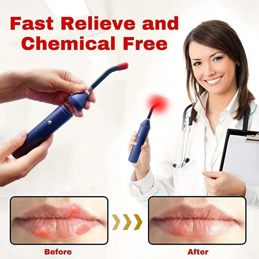 Red Light Therapy Wand Portable Red Light Infrared Therapy Device Handheld Removable Physiotherapy Lip Therapy Oral Physiotherapy Health Pain Relief