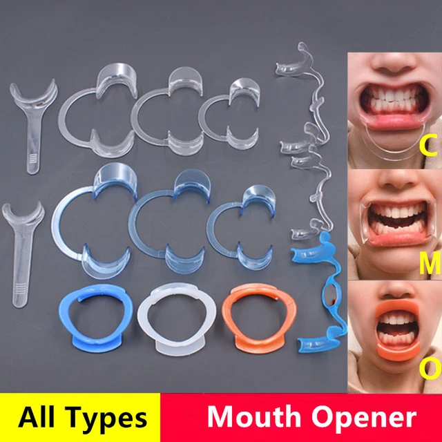 Ouvre-bouche En Forme De M, 10 Pièces, Écarteur De Joues, Outils Dentaire  Pour Le Blanchiment Des Dents, Instrument De Dentiste - Écarteurs De Joue  Et Accessoires De Bouche - AliExpress