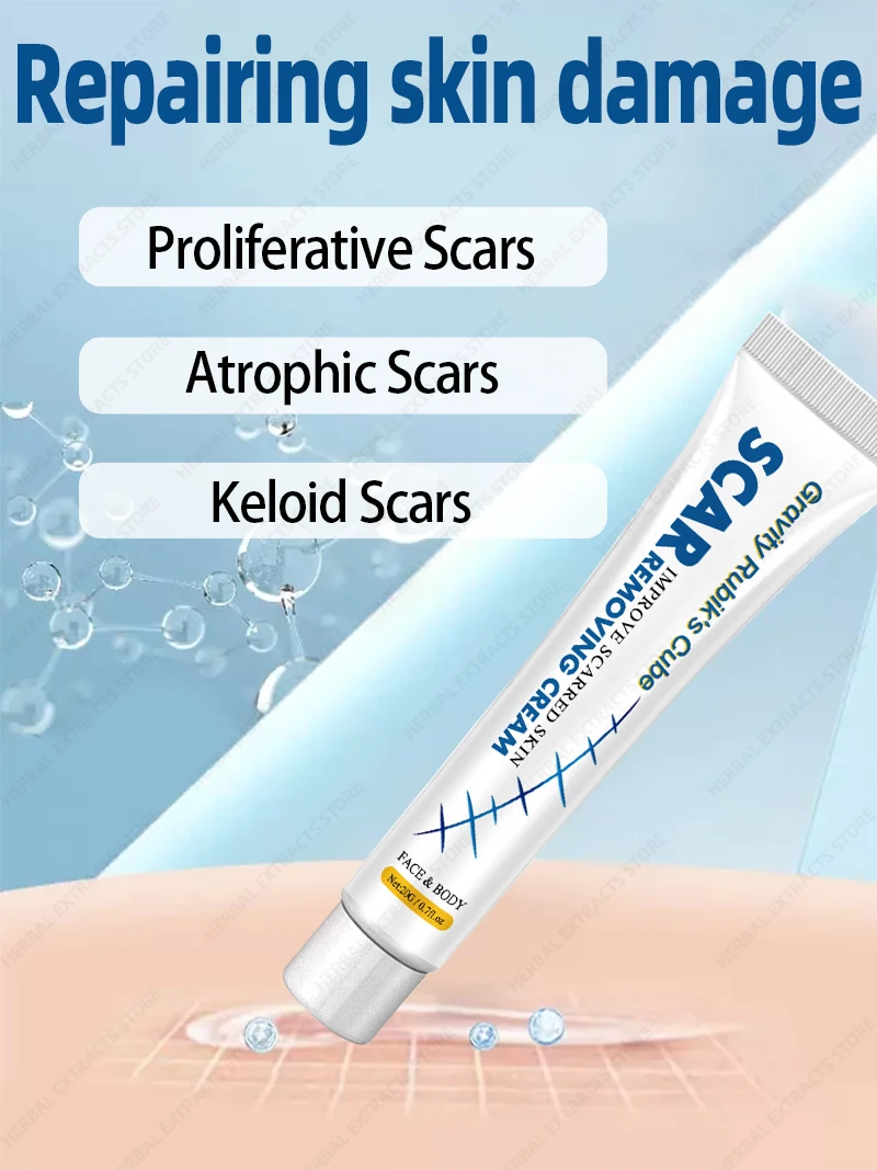 Scar Removal Cream Trauma Stretch Marks Keloid Atrophic Hypertrophic Scars Repair